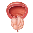 Enlarged Prostate/BPH treatment