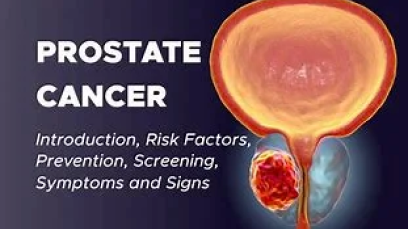 assets/photos/blogs/home-prostate-cancer-img.png