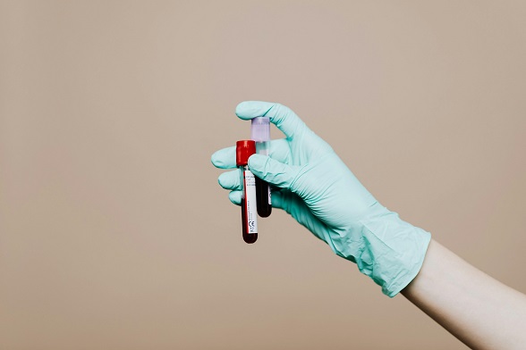 Showcasing PSA testing kit in doctor’s hand