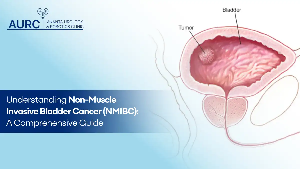 Non-Muscle Invasive Bladder Cancer (NMIBC)